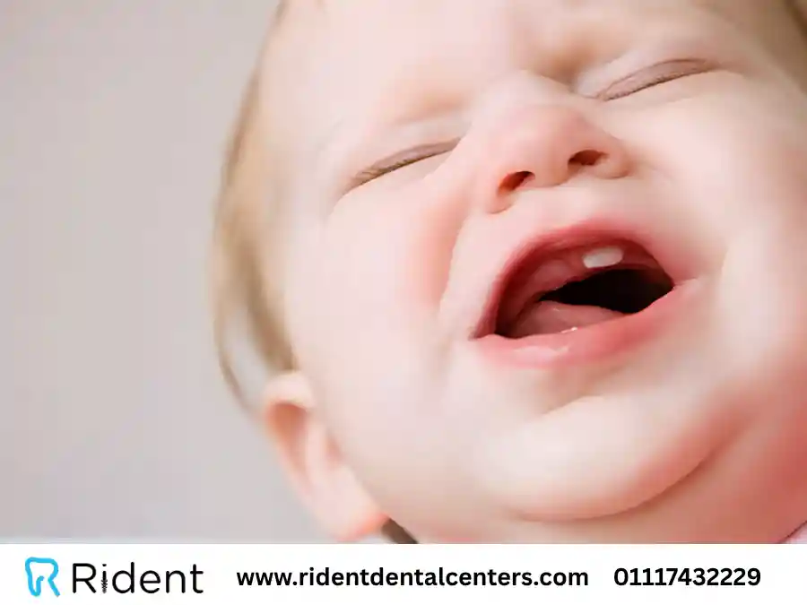 تخفيف ألم الأسنان للاطفال الرضع: تعلمي كيف يُمكن أن تمُر تلك الفترة بسلام